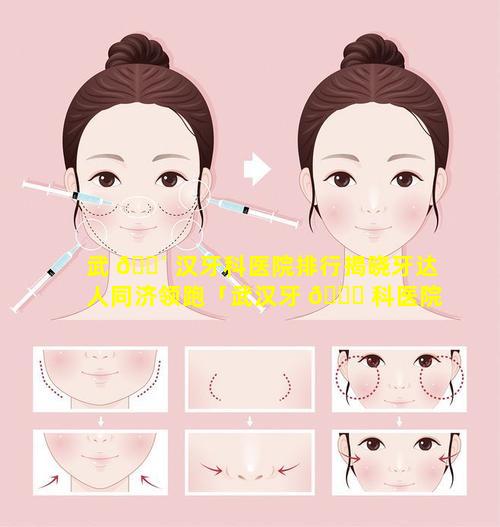 武 🌴 汉牙科医院排行揭晓牙达人同济领跑「武汉牙 🕊 科医院排名前十」